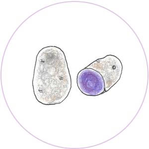 新じゃが（シャドークイーン）